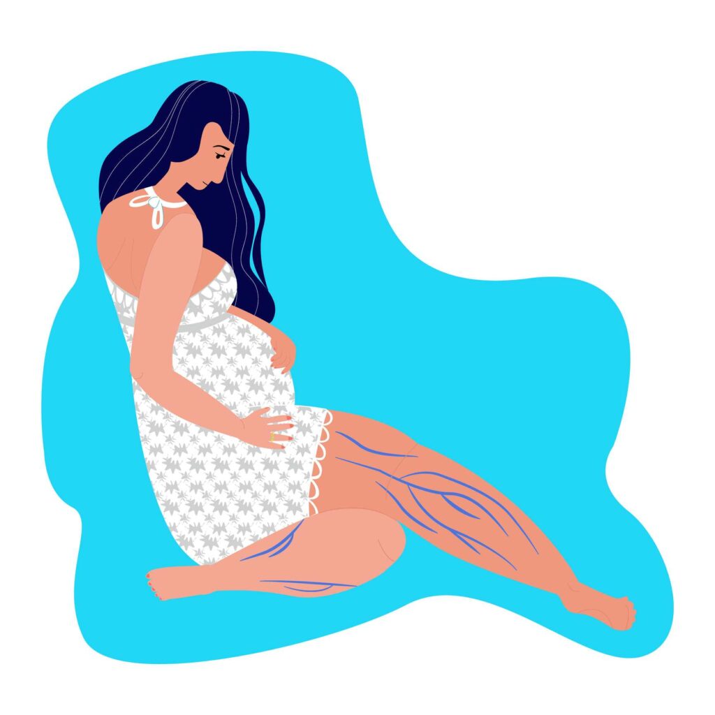 graphical photo of pregnant woman streching legs