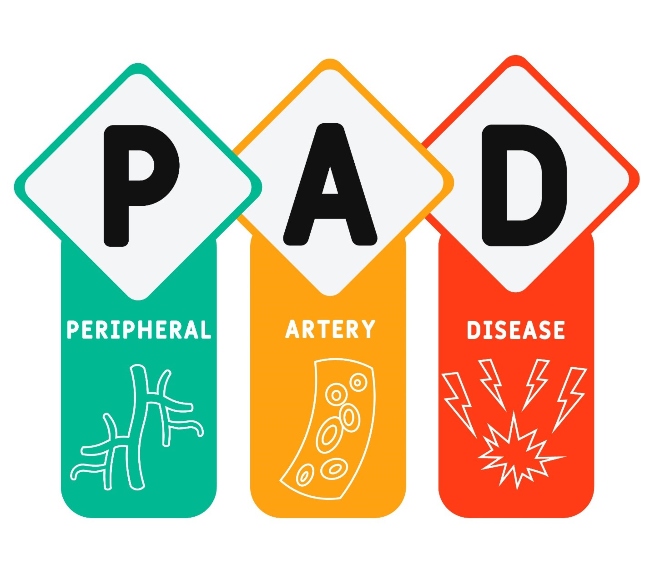 The explanation image for PAD The explanation image for PAD