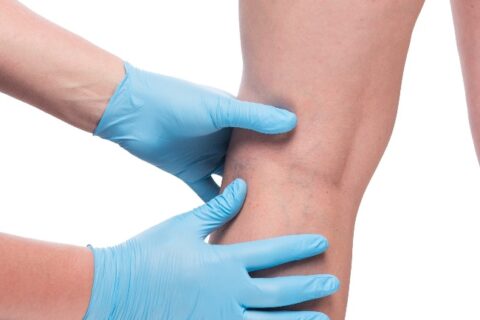 doctor using his hand to check the knees of the patient using glove at Phoenix, AZ