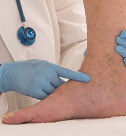 Doctor checking the patient varicose veins in leg at Phoenix, AZ Doctor checking the patient varicose veins in leg at Phoenix, AZ