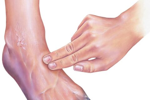 The person giving treatment for ankle disease using two fingers of hand is touched.