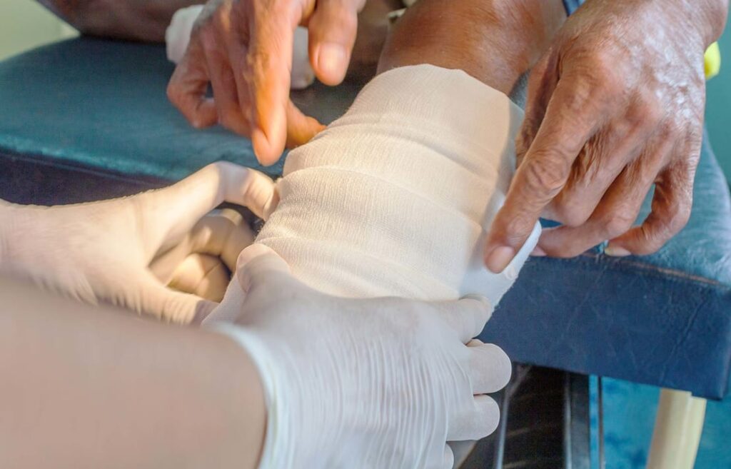 Doctor putting bandage for Leg Ulcer patient at Phoenix, AZ A Medical Professional Examines a Patient with Leg Ulcers in Phoenix, AZ