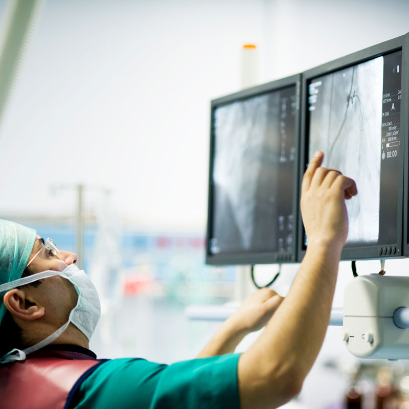 Angioplasty Procedure Being Performed, Highlighting the Balloon Catheter in Use, In Arizona
