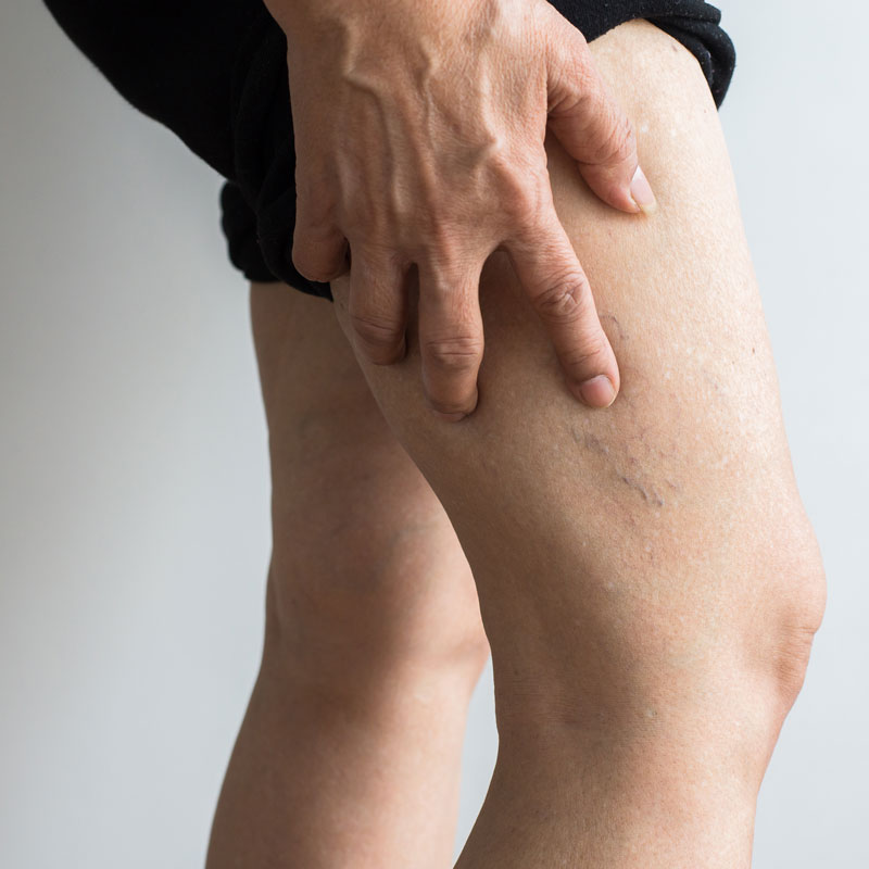 person holding leg in pain