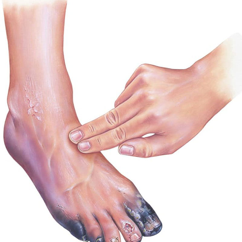 had and foot with blackness