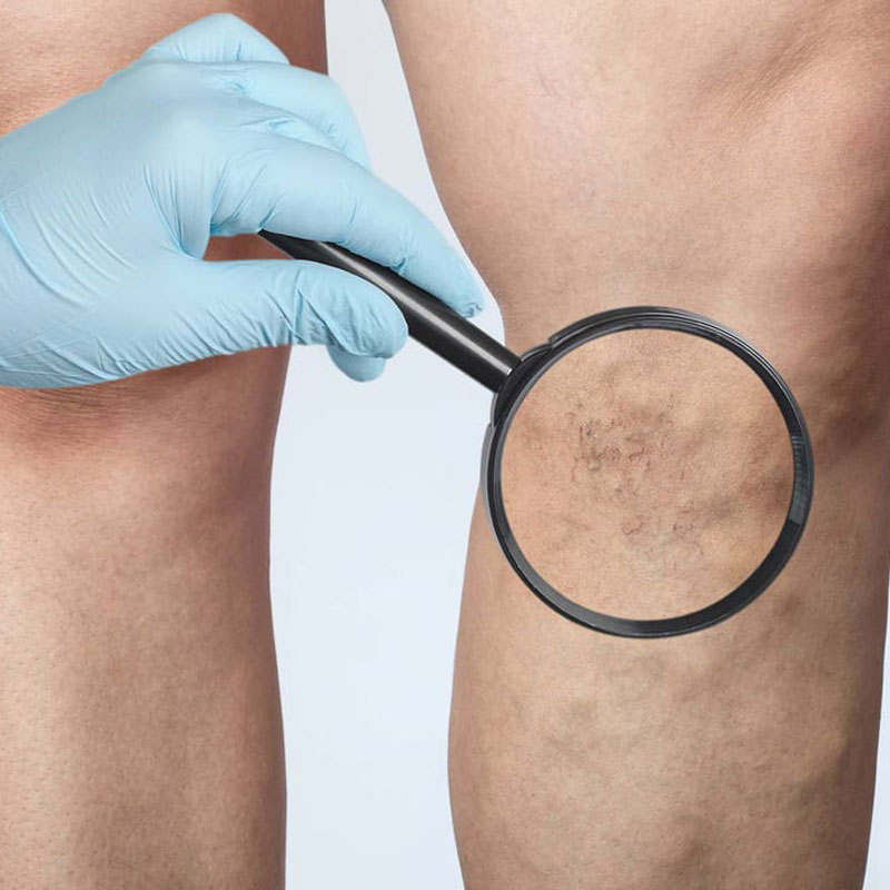 legs and magnifying glass