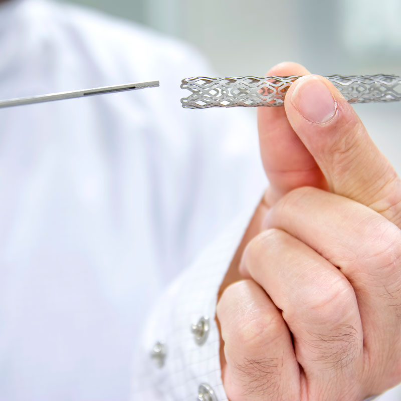 Stent Placement Procedure, Showing the Stent, and Catheter in Use, In Arizona