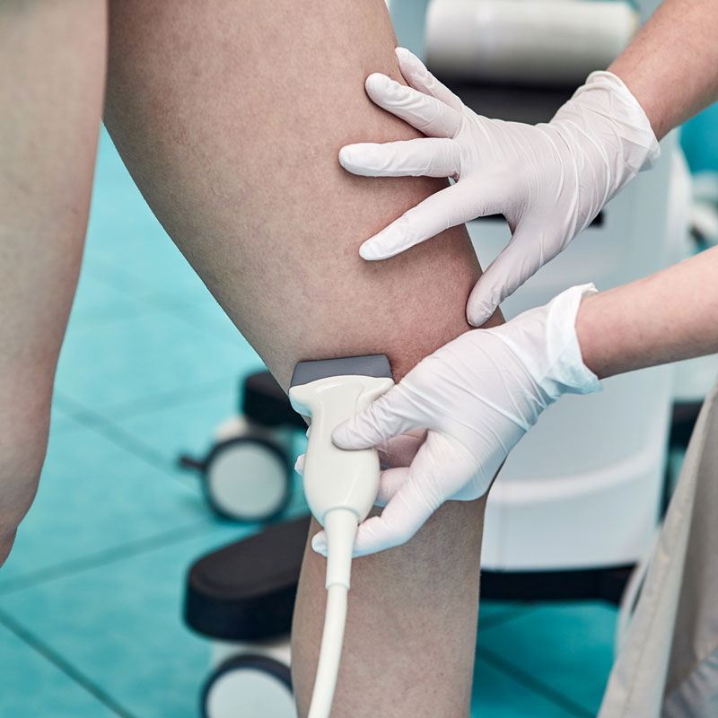 A healthcare professional uses a Diagnostic Ultrasound Vascular on a patient's knee in Phoenix, AZ.