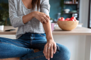 Woman scratching her arm