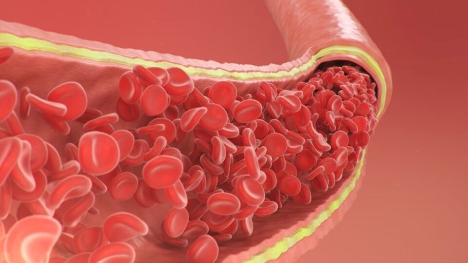 A cross-section of a vein showing blood cells in it by Arizona Vein & Laser Institute