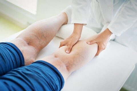 Doctor examining patient’s leg with visible varicose veins in Phoenix, AZ, & surrounding areas