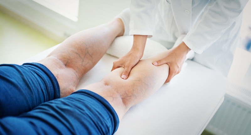 Doctor examining patient’s leg with visible varicose veins in Phoenix, AZ, & surrounding areas